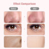 Ultrasonic Skin Scrubber Deep Face Cleaning Machine | Deep Skin Spa - Image 5