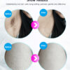 Laser Hair Removal for Woman and Man - Image 4